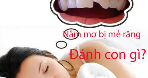 Nằm mơ thấy bị mẻ răng là điềm gì và đánh con gì dễ trúng?